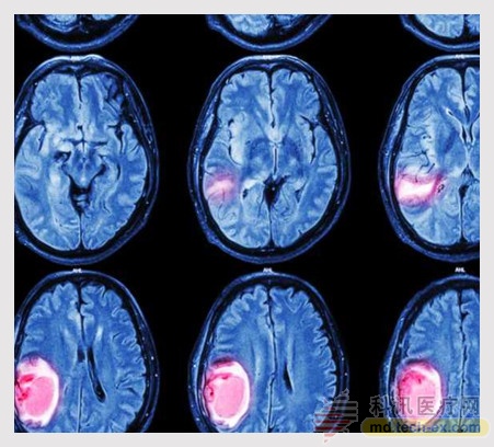 The general process is to collect 3D slice data of organs by means of diagnostic tools such as MRT/CT.