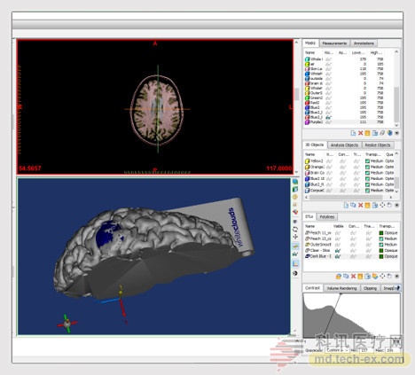 The software then automatically models and converts to a 3D printed format.