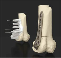 German company can print a variety of medical devices in 3D