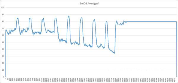 Practical feelings of MOXY muscle oxygen sensor