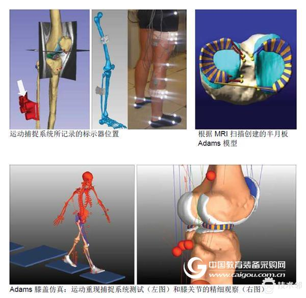 University of Missouri-Adams simulation helps diagnose knee disease