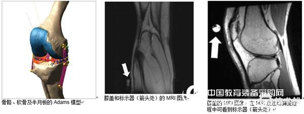 University of Missouri-Adams simulation helps diagnose knee disease