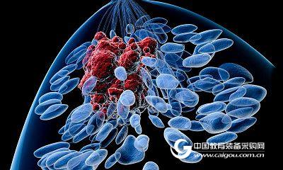 Scientists have found a mechanism of drug resistance in breast cancer