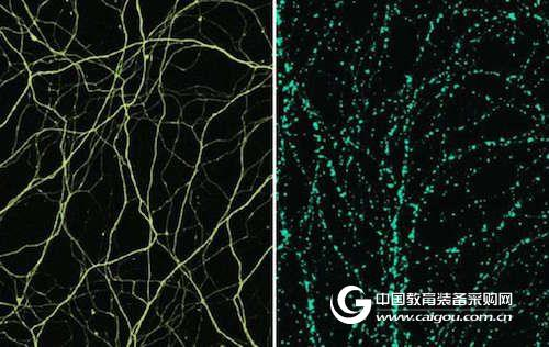 New research provides clues to the treatment of neurodegenerative diseases from the root cause