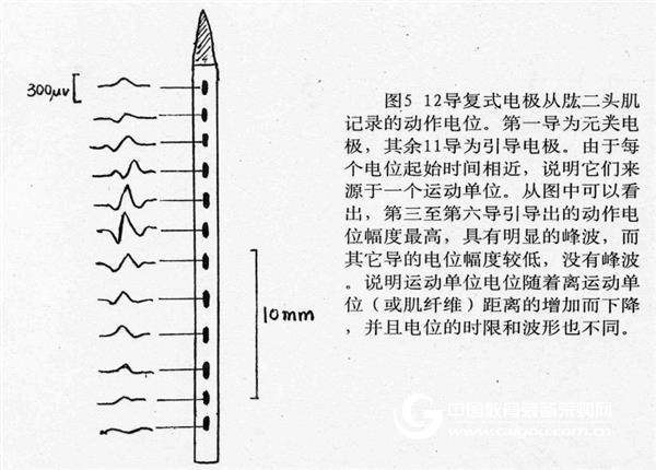 Guide and test of skeletal muscle electrical activity