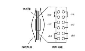 Application examples of myoelectric surface electrodes