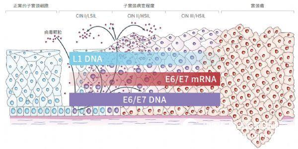 HPV E6/E7 DNA detection to avoid missed detection