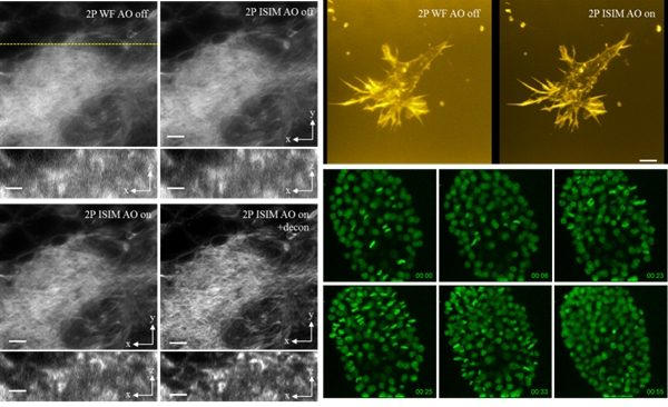Progress in super-resolution optical microscopy in Shenzhen Advanced Institute