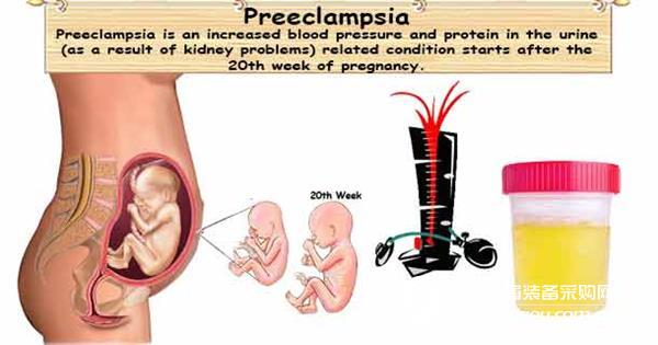 Science: Pregnancy-induced hypertension is not induced by high blood pressure, it is a lack of hormones