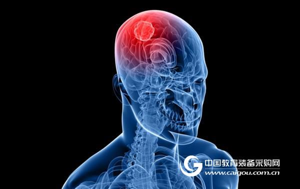 CRISPR application re-expands key genetic mutations in malignant brain tumors