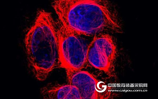 The mystery of the cytoskeleton has been solved, and the results of the research are the same as the Science