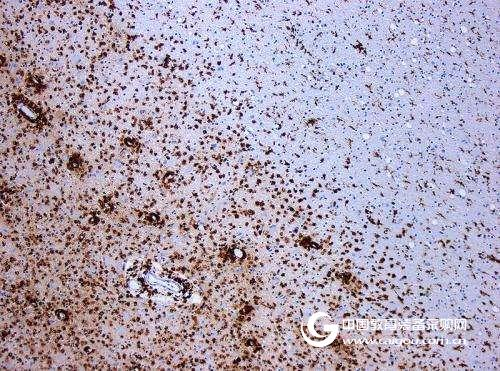 Taurine repairs damaged cells of multiple sclerosis