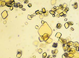 Application of polarized light microscope in drug testing