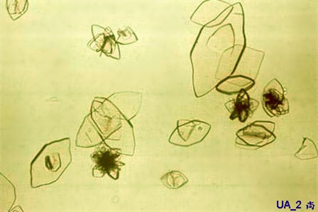 Application of polarized light microscope in drug testing