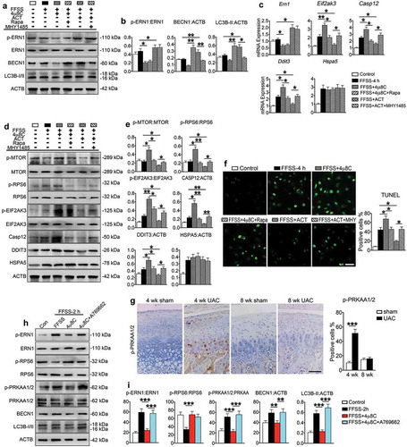 Advances in autophagy and apoptosis signals of osteoarthritic chondrocytes