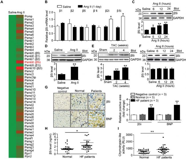 Dalian Medical University published a scientific article: the new role of Î²5i in the development of cardiac hypertrophy