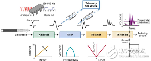 Implantable cardioverter defibrillator prevents cardiac arrest, and electronic technology contributes greatly