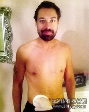 Bodybuilder removes colon to reshape perfect body