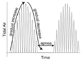 Figure 1 Breathing characteristics and time parameters