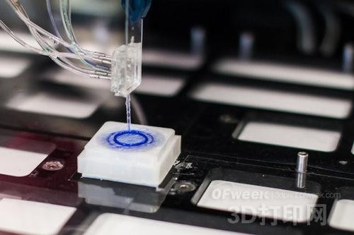 A major breakthrough in the medical field: 3D printing human tissue will be realized