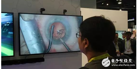 In 2017, Kangde's new naked-eye 3D technology will break the display industry deadlock?