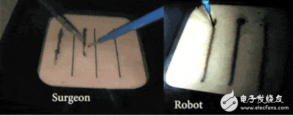 The robot has already picked up the scalpel, which is faster than people.