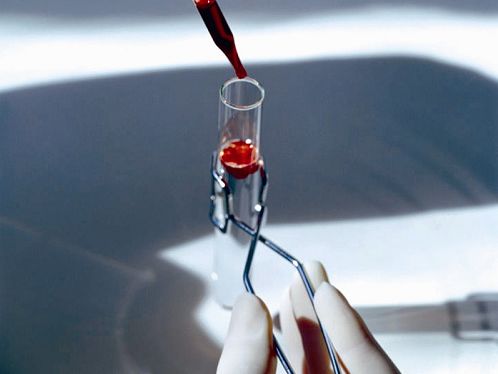Blood "fingerprint" blood test predicts longevity