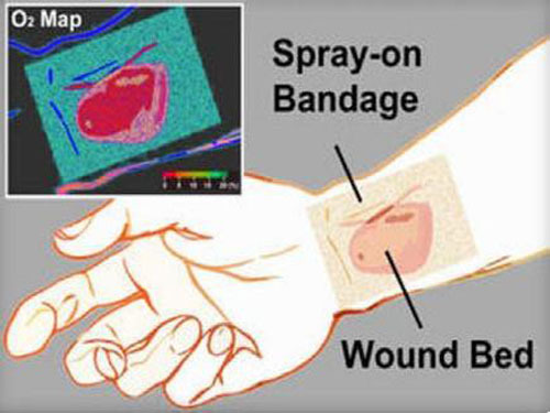 "Smart Bandage" to Accelerate Wound Healing