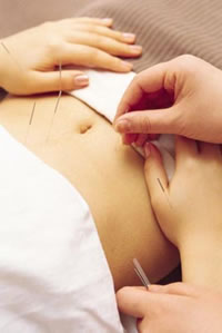 Acupuncture weight loss knowledge