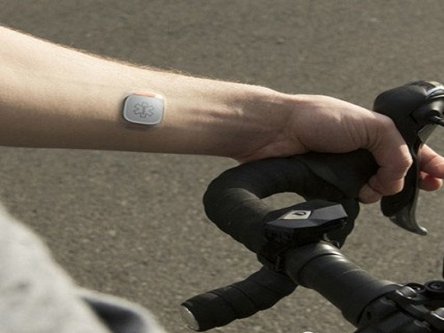 Wearable sensors predict the onset of epilepsy