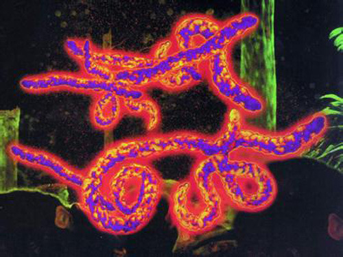 The Ebola virus There are five things you must know