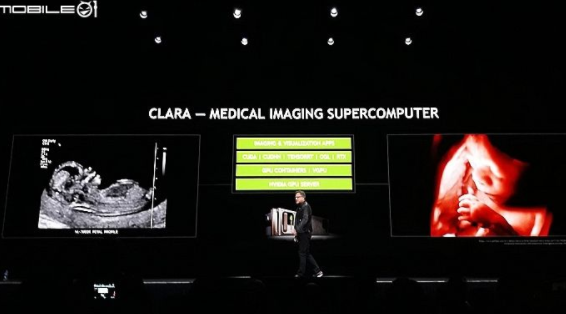 NVIDIA cross-border medical research and development of medical imaging AI platform