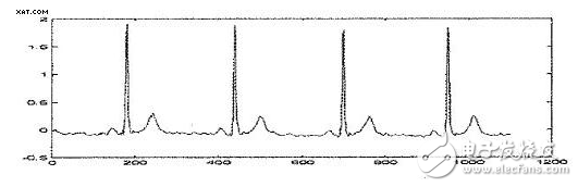 Application of Wavelet Threshold Denoising