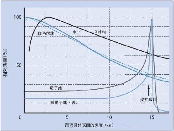 åšæ‹‰æ ¼è´¨å­æ²»ç–—ä¸­å¿ƒï¼šè´¨å­ä¸Žé‡ç¦»å­ç›¸ä¼¼ä¸ç›¸åŒ éƒ¨åˆ†æ‚£è€…ä¸é€‚äºŽé‡ç¦»å­æ²»ç–—