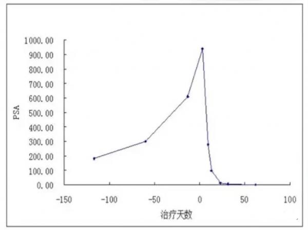 å‘Šåˆ«è‚¿ç˜¤æˆä¸ºå¯èƒ½â€”â€”æŠ—PD-L1å¼ºæ•ˆè‚¿ç˜¤ç–«è‹—ç™»é™†ä¸­å›½