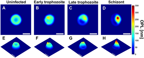 Duke University designs new technologies for holographic medical imaging and diagnosis of malaria