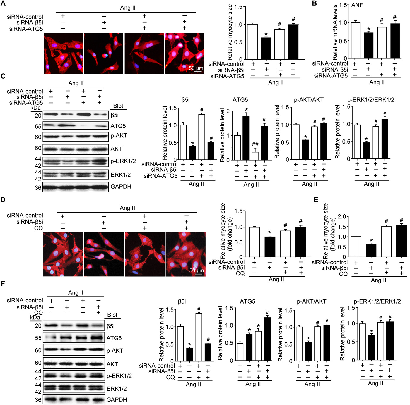 Dalian Medical University published a scientific article: the new role of Î²5i in the development of cardiac hypertrophy