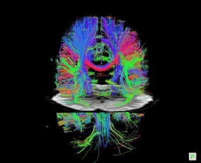 New technology enables brain 3D imaging scans to be completed in half a second (Figure)