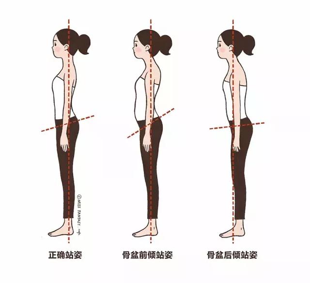 Itâ€™s useless to stand up straight. These posture problems have sold you out.