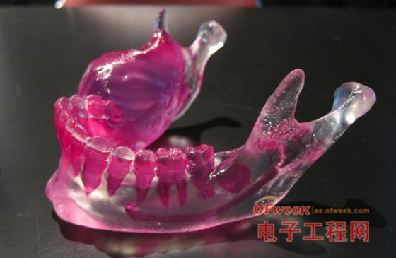 3D printing boost surgery
