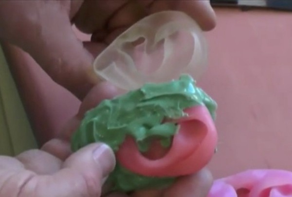 3D printing 100% reproduction of the patient's body parts