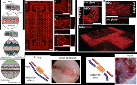 AngioChip, an vascular tissue scaffold chip, solves the big problem of artificial organs