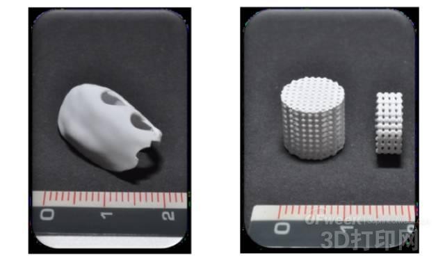 Degradable 3D printed ceramic stent for bone tumor treatment