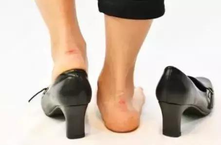 Shoes buy small squeeze feet and wear feet? The shoe store owner taught me this coup, the shoes are comfortable and fit.