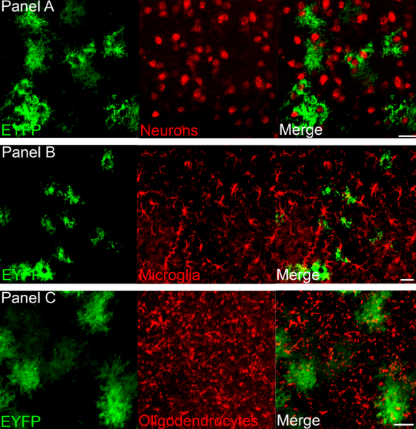 AAV5 specifically expresses ChR2-EYFP in astrocytes