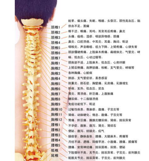 Since the source of all diseases in the spine -1