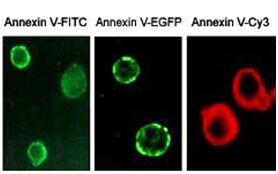 Annexin V ä¸Žç»†èƒžå‡‹äº¡çš„ä¸è§£ä¹‹ç¼˜