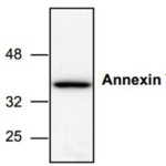 Annexin V ä¸Žç»†èƒžå‡‹äº¡çš„ä¸è§£ä¹‹ç¼˜