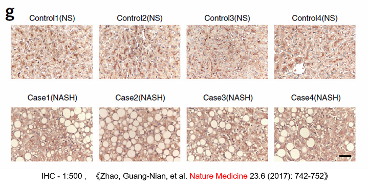 IHC HRP-labeled goat anti-rabbit secondary antibody