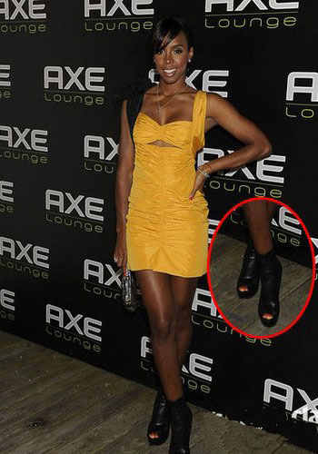 Open-toe boots are in season, showcasing sensual details (Figure 3)